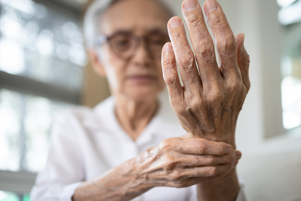 patient with rheumatoid arthritis