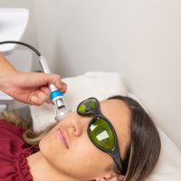 The Role of Laser Therapy in Treating Bell’s Palsy