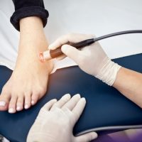 Ankle Sprains: Accelerated Healing with Cutting-Edge, Laser Therapy